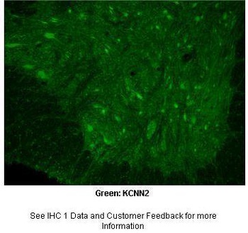 KCNN2 Antibody