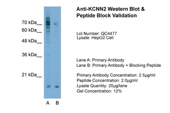 KCNN2 Antibody