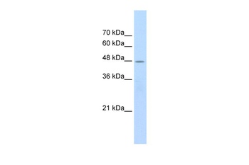 CHRNB2 Antibody