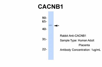 CACNB1 Antibody