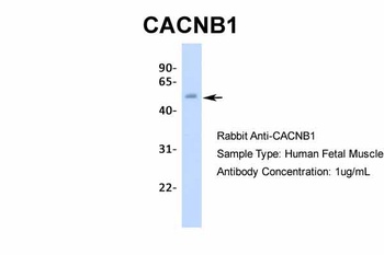 CACNB1 Antibody