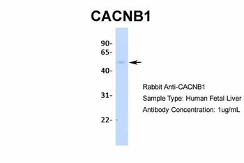 CACNB1 Antibody
