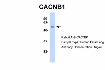 CACNB1 Antibody