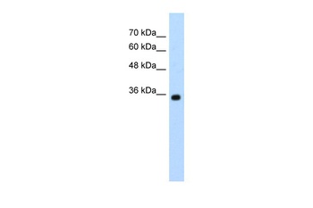 ZMYND11 Antibody