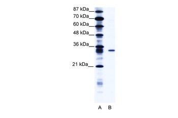 KCNIP4 Antibody