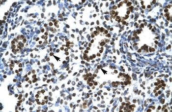 NACC1 Antibody