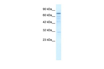 TRMT1 Antibody