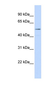 SUV420H1 Antibody