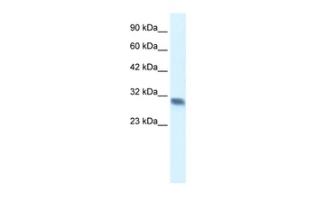 FHL2 Antibody