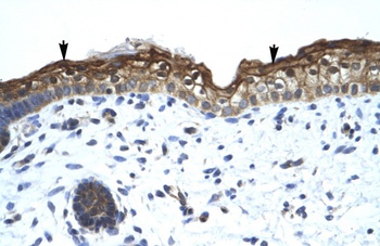 SMARCA2 Antibody