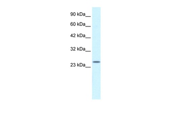 ZFAND6 Antibody