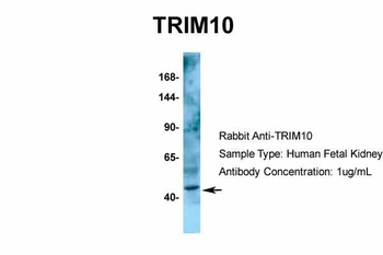 TRIM10 Antibody