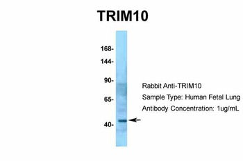 TRIM10 Antibody