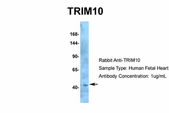 TRIM10 Antibody