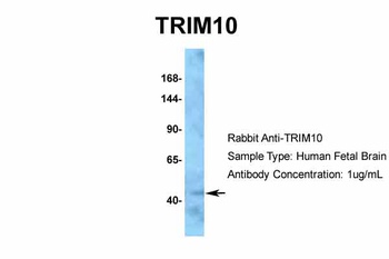 TRIM10 Antibody