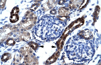 AKAP17A Antibody