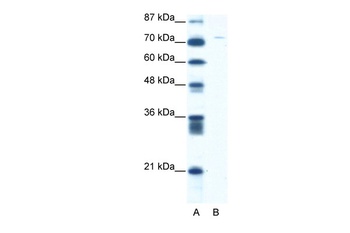 ASPH Antibody