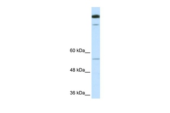 TIMELESS Antibody