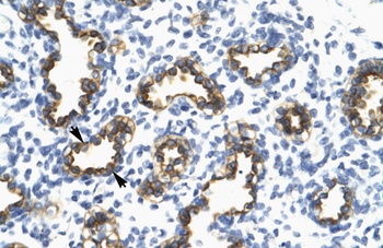 TRIM13 Antibody