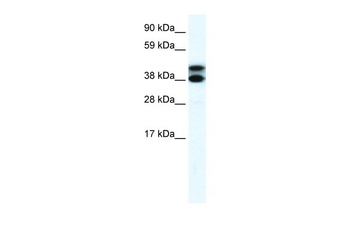 TRIM13 Antibody