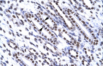 XRCC6 Antibody