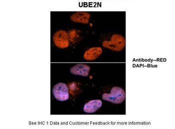 UBE2N Antibody