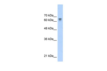 PARP6 Antibody