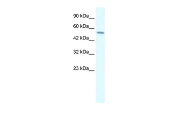 RGS6 Antibody