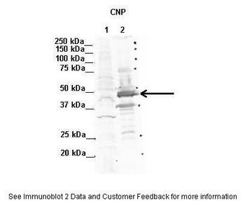 CNP Antibody