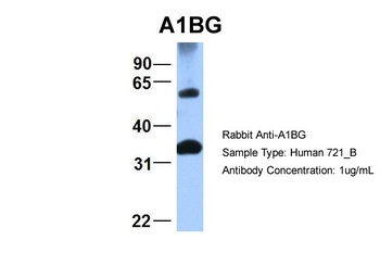 ACAT2 Antibody