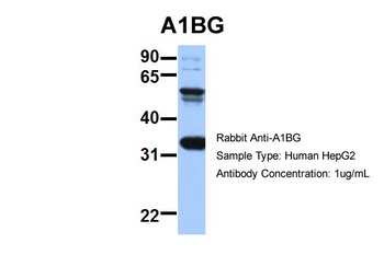 ACAT2 Antibody