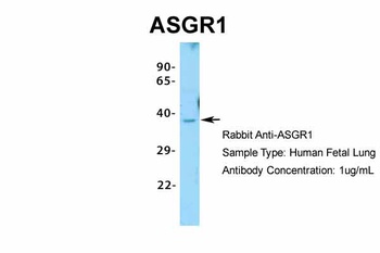 ASGR1 Antibody