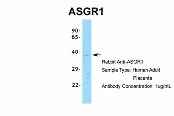 ASGR1 Antibody