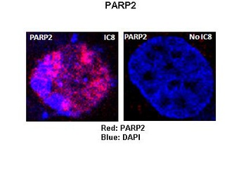 PARP2 Antibody