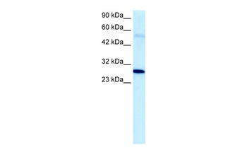 PARP1 Antibody