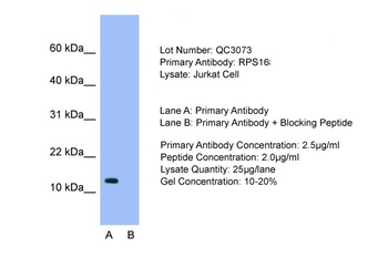 RPS16 Antibody