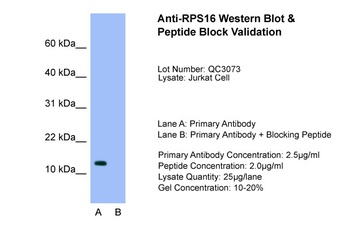 RPS16 Antibody