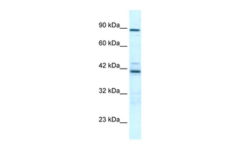 TBX5 Antibody