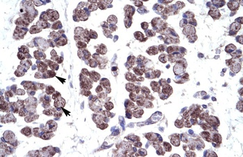 TBX20 Antibody