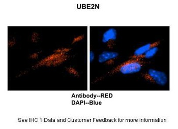 UBE2N Antibody