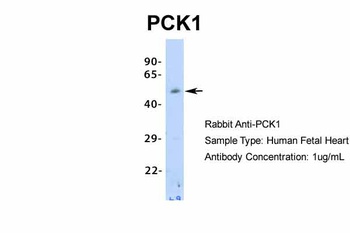 PCK1 Antibody