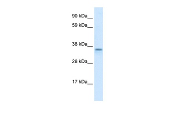 ZC2HC1A Antibody