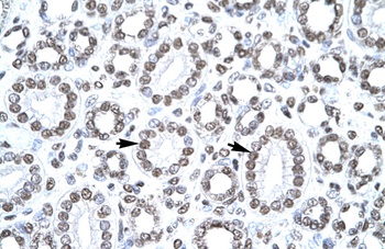 CITED1 Antibody