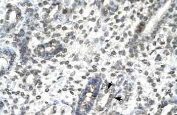 TBX21 Antibody