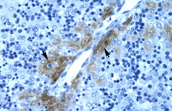 GATA3 Antibody
