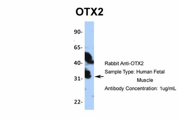 OTX2 Antibody