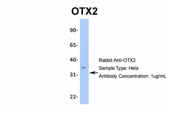 OTX2 Antibody