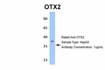 OTX2 Antibody