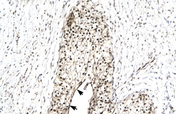 RUVBL2 Antibody