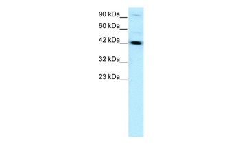 HNF1B Antibody
